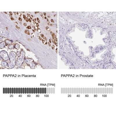 Immunohistochemistry-Paraffin: Pappalysin-2/PAPP-A2 Antibody [NBP1-87340] - Analysis in human placenta and prostate tissues using NBP1-87340 antibody. Corresponding PAPPA2 RNA-seq data are presented for the same tissues.