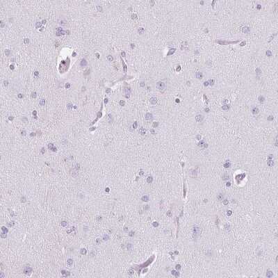 Immunohistochemistry-Paraffin: Pappalysin-2/PAPP-A2 Antibody [NBP1-87340] - Staining of human cerebral cortex shows no positivity in neurons as expected.