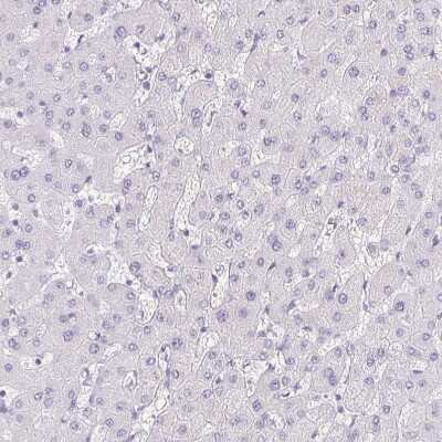 Immunohistochemistry-Paraffin: Pappalysin-2/PAPP-A2 Antibody [NBP1-87340] - Staining of human liver shows no positivity in hepatocytes as expected.