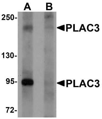 Western Blot: Pappalysin-2/PAPP-A2 Antibody [NBP1-76487] - HeLa cell lysate at 1 ug/mL in (A) the absence and (B) the presence of blocking peptide.