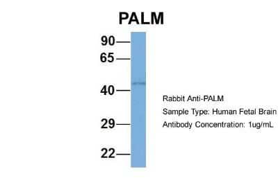 Western Blot: Paralemmin Antibody [NBP1-79624] - Human Fetal Brain, Antibody Dilution: 1.0 ug/ml.