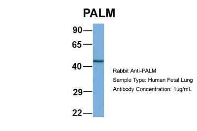 Western Blot Paralemmin Antibody - BSA Free