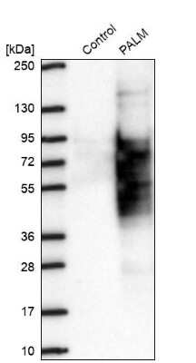 Western Blot Paralemmin Antibody - BSA Free