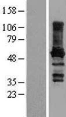 Western Blot: Paralemmin Overexpression Lysate (Adult Normal) [NBL1-14087] Left-Empty vector transfected control cell lysate (HEK293 cell lysate); Right -Over-expression Lysate for Paralemmin.