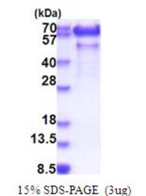 SDS-PAGE Recombinant Human Paralemmin His Protein