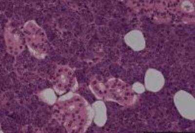 Hematoxylin & Eosin Stain: Parotid Tissue Slides (Normal) [NBP2-30192] -  Parotid gland, normal.  Age/Sex: 37/F