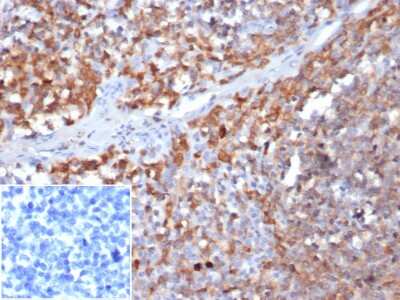 Immunohistochemistry-Paraffin: Parvin gamma Antibody (8C5.2) [NBP3-07835] - Formalin-fixed, paraffin-embedded human tonsil stained with Parvin gamma Antibody (8C5.2) at 2ug/ml in PBS. Inset: PBS instead of primary, secondary only antibody control.