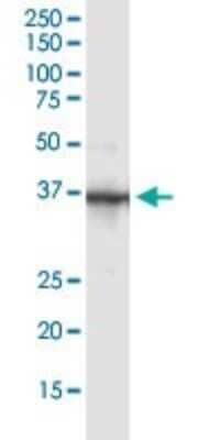 Immunoprecipitation: Parvin gamma Antibody [H00064098-B01P] - Immunoprecipitation of Parvin gamma transfected lysate using anti-PARVG MaxPab mouse polyclonal antibody and Protein A Magnetic Bead, and immunoblotted with PARVG purified MaxPab rabbit polyclonal antibody.