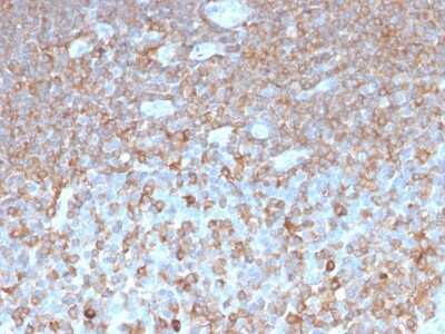 Immunohistochemistry-Paraffin: Parvin gamma Antibody (PARVG/6312R) - Azide and BSA Free [NBP3-08729] - Formalin-fixed, paraffin-embedded human tonsil stained with Parvin gamma Recombinant Rabbit Monoclonal Antibody (PARVG/6312R).