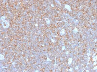 Immunohistochemistry-Paraffin: Parvin gamma Antibody (PARVG/6312R) - Azide and BSA Free [NBP3-08729] - Formalin-fixed, paraffin-embedded human tonsil stained with Parvin gamma Recombinant Rabbit Monoclonal Antibody (PARVG/6312R).