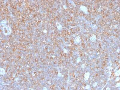 Immunohistochemistry-Paraffin: Parvin gamma Antibody (PARVG/6312R) [NBP3-07836] - Formalin-fixed, paraffin-embedded human tonsil stained with Parvin gamma Recombinant Rabbit Monoclonal Antibody (PARVG/6312R).