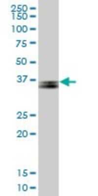 Western Blot: Parvin gamma Antibody [H00064098-B01P] - Analysis of PARVG expression in human spleen.