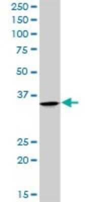 Western Blot Parvin gamma Antibody