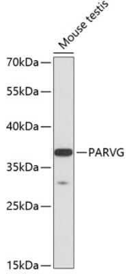 Western Blot: Parvin gamma Antibody [NBP2-93508] - Analysis of extracts of mouse testis, using Parvin gamma at 1:3000 dilution.Secondary antibody: HRP Goat Anti-Rabbit IgG (H+L) at 1:10000 dilution.Lysates/proteins: 25ug per lane.Blocking buffer: 3% nonfat dry milk in TBST.Detection: ECL Basic Kit .Exposure time: 90s.