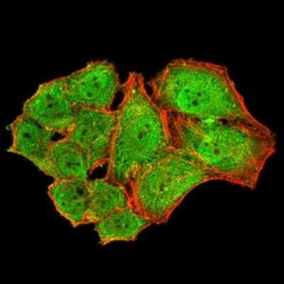 Immunocytochemistry/Immunofluorescence: Parvovirus  NS1 Antibody (8E6E10) [NBP2-61903] - Analysis of Hela cells using NS1 mouse mAb (green). Blue: DRAQ5 fluorescent DNA dye. Red: Actin filaments have been labeled with Alexa Fluor- 555 phalloidin. Goat anti-Mouse IgG (H+L) DyLight 488 secondary antibody was used. 