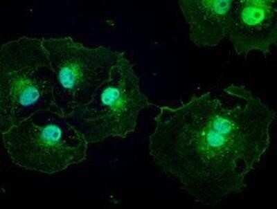 Immunocytochemistry/Immunofluorescence: Patched 1/PTCH Antibody (OTI5C7) - Azide and BSA Free [NBP2-73253] - Staining of COS7 cells transiently transfected by pCMV6-ENTRY Patched 1.