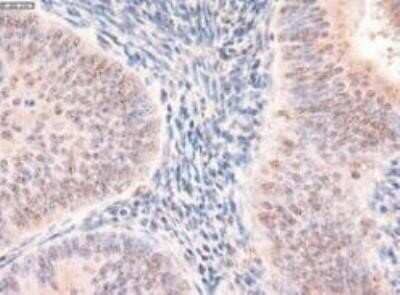 Immunohistochemistry: Patched 1/PTCH Antibody (OTI5C7) - Azide and BSA Free [NBP2-73253] - Human endometrium tissue.