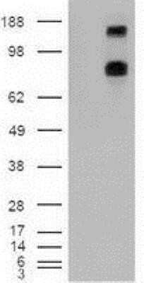 Western Blot: Patched 1/PTCH Antibody (OTI5C7) - Azide and BSA Free [NBP2-73253] - HEK293T cells were transfected with the pCMV6-ENTRY control (Left lane) or pCMV6-ENTRY Patched 1 (Right lane) cDNA for 48 hrs and lysed. Equivalent amounts of cell lysates (5 ug per lane) were separated by SDS-PAGE and immunoblotted with anti-Patched 1.