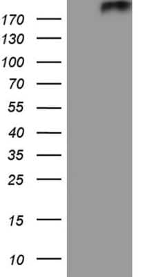 SDS-Page: Patched 2/PTCH2 Antibody (OTI8B5) [NBP2-45440] - Analysis of HEK293T cells were transfected with the pCMV6-ENTRY control (Left lane) or pCMV6-ENTRY PTCH2.