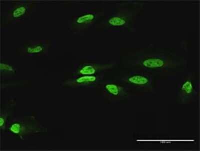 Immunocytochemistry/Immunofluorescence: Pax2 Antibody [H00005076-D01P] - Analysis of antibody to PAX2 on HeLa cell. Antibody concentration 10 ug/ml.