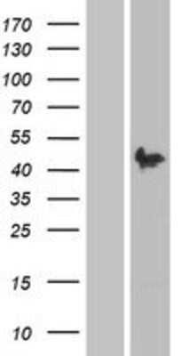 Western Blot: Pax2 Overexpression Lysate (Adult Normal) [NBP2-04156] Left-Empty vector transfected control cell lysate (HEK293 cell lysate); Right -Over-expression Lysate for Pax2.