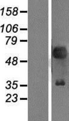 Western Blot: Pax2 Overexpression Lysate (Adult Normal) [NBP2-07925] Left-Empty vector transfected control cell lysate (HEK293 cell lysate); Right -Over-expression Lysate for Pax2.