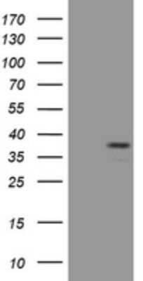 Western Blot: Pax4 Antibody (OTI2F3) - Azide and BSA Free [NBP2-73257] - Analysis of HEK293T cells were transfected with the pCMV6-ENTRY control (Left lane) or pCMV6-ENTRY PAX4.