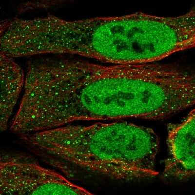 Immunocytochemistry/Immunofluorescence: Pax5/BSAP Antibody [NBP2-57885] - Staining of human cell line U-2 OS shows localization to nucleoplasm & vesicles.