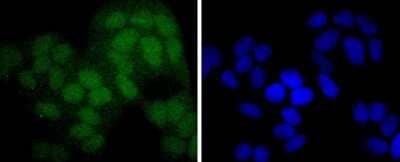 Immunocytochemistry/Immunofluorescence: Pax5/BSAP Antibody (JJ08-87) [NBP2-67874] - Staining PAX5 in Hela cells (green). The nuclear counter stain is DAPI (blue). Cells were fixed in paraformaldehyde, permeabilised with 0.25% Triton X100/PBS.