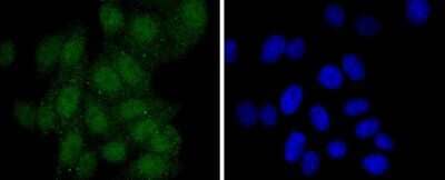 Immunocytochemistry/Immunofluorescence: Pax5/BSAP Antibody (JJ08-87) [NBP2-67874] - Staining PAX5 in HepG2 cells (green). The nuclear counter stain is DAPI (blue). Cells were fixed in paraformaldehyde, permeabilised with 0.25% Triton X100/PBS.