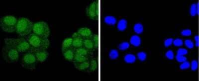 Immunocytochemistry/Immunofluorescence: Pax5/BSAP Antibody (JJ08-87) [NBP2-67874] - Staining PAX5 in MCF-7 cells (green). The nuclear counter stain is DAPI (blue). Cells were fixed in paraformaldehyde, permeabilised with 0.25% Triton X100/PBS.