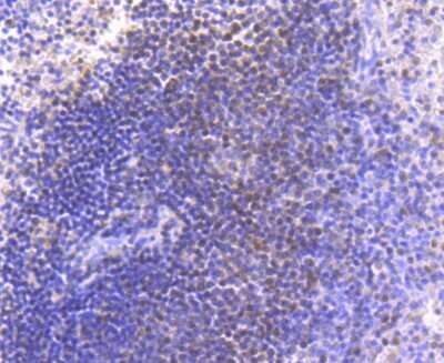 Immunohistochemistry-Paraffin: Pax5/BSAP Antibody (JJ08-87) [NBP2-67874] - Analysis of paraffin-embedded human spleen tissue using anti-PAX5 antibody. Counter stained with hematoxylin.