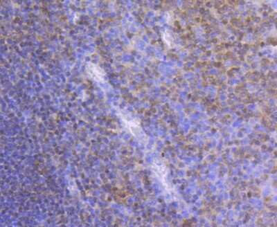 Immunohistochemistry-Paraffin: Pax5/BSAP Antibody (JJ08-87) [NBP2-67874] - Analysis of paraffin-embedded human tonsil tissue using anti-PAX5 antibody. Counter stained with hematoxylin.