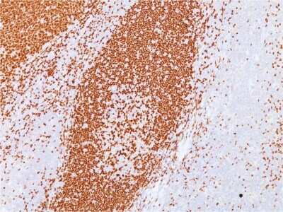 Immunohistochemistry-Paraffin: Pax5/BSAP Antibody (PAX5/3735) - Azide and BSA Free [NBP3-08418] - Formalin-fixed, paraffin-embedded human Tonsil stained with Pax5/BSAP Mouse Monoclonal Antibody (Pax5/BSAP/3735).