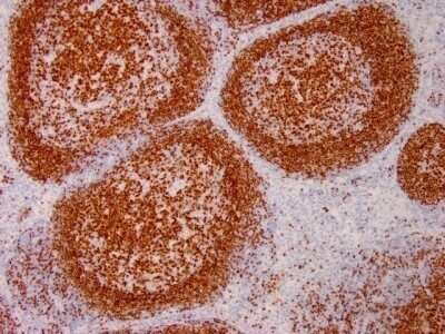 Immunohistochemistry-Paraffin: Pax5/BSAP Antibody (PAX5/3735) - Azide and BSA Free [NBP3-08418] - Formalin-fixed, paraffin-embedded human Tonsil stained with Pax5/BSAP Mouse Monoclonal Antibody (Pax5/BSAP/3735).