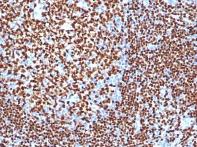 Immunohistochemistry-Paraffin: Pax5/BSAP Antibody (PAX5/3977R) - Azide and BSA Free [NBP3-08310] - Formalin-fixed, paraffin-embedded human tonsil stained with Pax5/BSAP Recombinant Rabbit Monoclonal Antibody (Pax5/BSAP/3977R).