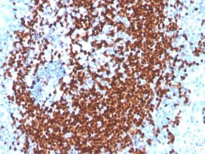 Immunohistochemistry-Paraffin: Pax5/BSAP Antibody (PAX5/3977R) - Azide and BSA Free [NBP3-08310] - Formalin-fixed, paraffin-embedded human tonsil stained with Pax5/BSAP Recombinant Rabbit Monoclonal Antibody (Pax5/BSAP/3977R).