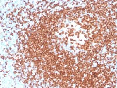 Immunohistochemistry-Paraffin: Pax5/BSAP Antibody (rPAX5/4228) - Azide and BSA Free [NBP3-08419] - Formalin-fixed, paraffin-embedded human tonsil stained with Pax5/BSAP Recombinant Mouse Monoclonal Antibody (rPax5/BSAP/4228).