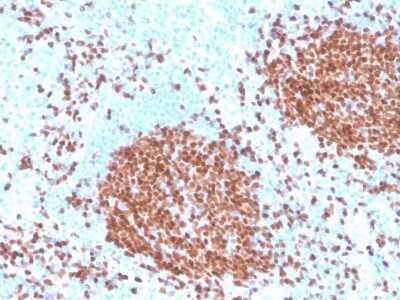 Immunohistochemistry-Paraffin: Pax5/BSAP Antibody (rPAX5/4228) - Azide and BSA Free [NBP3-08419] - Formalin-fixed, paraffin-embedded human tonsil stained with Pax5/BSAP Recombinant Mouse Monoclonal Antibody (rPax5/BSAP/4228).