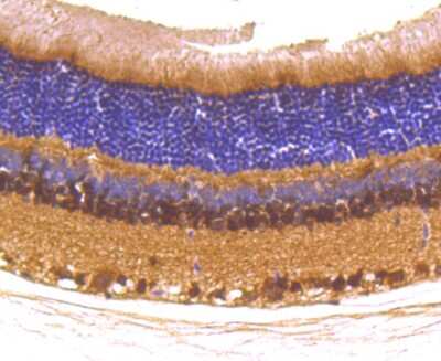 Immunohistochemistry-Paraffin: Pax6 Antibody (SD081-03) [NBP2-67789] - Analysis of paraffin-embedded rat eyes tissue using anti-PAX6 antibody. Counter stained with hematoxylin.