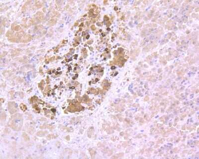Immunohistochemistry-Paraffin: Pax6 Antibody (SD081-03) [NBP2-67789] - Immunohistochemical analysis of paraffin-embedded human pancreas tissue using anti-Pax6 antibody. The section was pre-treated using heat mediated antigen retrieval with Tris-EDTA buffer (pH 8.0-8.4) for 20 minutes. The tissues were blocked in 5% BSA for 30 minutes at room temperature, washed with ddH2O and PBS, and then probed with the primary antibody (1/50) for 30 minutes at room temperature. The detection was performed using an HRP conjugated compact polymer system. DAB was used as the chromogen. Tissues were counterstained with hematoxylin and mounted with DPX.