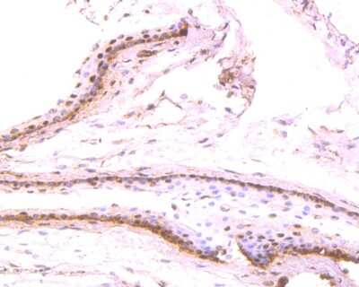 Immunohistochemistry-Paraffin: Pax6 Antibody (SD081-03) [NBP2-67789] - Immunohistochemical analysis of paraffin-embedded mouse eyeball tissue using anti-Pax6 antibody. The section was pre-treated using heat mediated antigen retrieval with Tris-EDTA buffer (pH 8.0-8.4) for 20 minutes. The tissues were blocked in 5% BSA for 30 minutes at room temperature, washed with ddH2O and PBS, and then probed with the primary antibody (1/50) for 30 minutes at room temperature. The detection was performed using an HRP conjugated compact polymer system. DAB was used as the chromogen. Tissues were counterstained with hematoxylin and mounted with DPX.