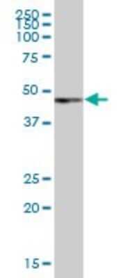 Western Blot: Pax6 Antibody [H00005080-B01P] - Analysis of PAX6 expression in human pancreas.