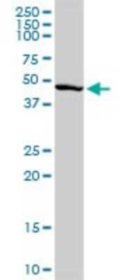 Western Blot: Pax6 Antibody [H00005080-D01P] - Analysis of PAX6 expression in human kidney.