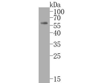 Western Blot: Pax7 Antibody (SD083-04) [NBP2-67792] - Western blot analysis of Pax7 on Hela cell lysates. Proteins were transferred to a PVDF membrane and blocked with 5% BSA in PBS for 1 hour at room temperature. The primary antibody (1/500) was used in 5% BSA at room temperature for 2 hours. Goat Anti-Rabb