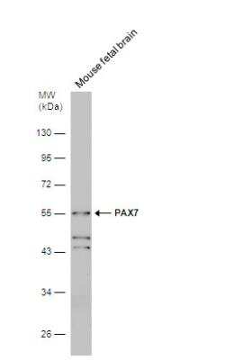 Western Blot: Pax7 Antibody [NBP1-31224] - Mouse tissue extract (50 ug) was separated by 10% SDS-PAGE, and the membrane was blotted with PAX7 antibody [C3], C-term diluted at 1:1000.