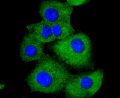 Immunocytochemistry/Immunofluorescence: Paxillin Antibody (SY23-02) [NBP2-67427] - Staining Paxillin in A549 cells (green). The nuclear counter stain is DAPI (blue). Cells were fixed in paraformaldehyde, permeabilised with 0.25% Triton X100/PBS.