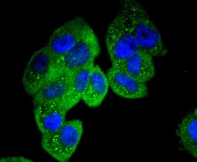Immunocytochemistry/Immunofluorescence: Paxillin Antibody (SY23-02) [NBP2-67427] - Staining Paxillin in Hela cells (green). The nuclear counter stain is DAPI (blue). Cells were fixed in paraformaldehyde, permeabilised with 0.25% Triton X100/PBS.