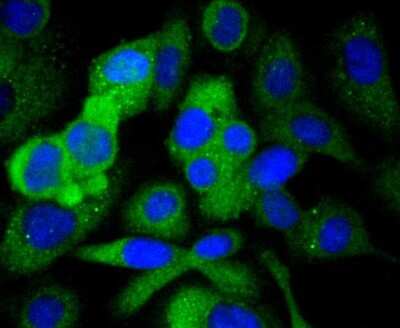 Immunocytochemistry/Immunofluorescence: Paxillin Antibody (SY23-02) [NBP2-67427] - Staining Paxillin in SKOV-3 cells (green). The nuclear counter stain is DAPI (blue). Cells were fixed in paraformaldehyde, permeabilised with 0.25% Triton X100/PBS.