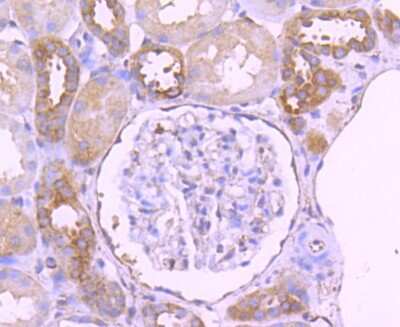 Immunohistochemistry-Paraffin: Paxillin Antibody (SY23-02) [NBP2-67427] - Analysis of paraffin-embedded human kideny tissue using anti-Paxillin antibody. Counter stained with hematoxylin.